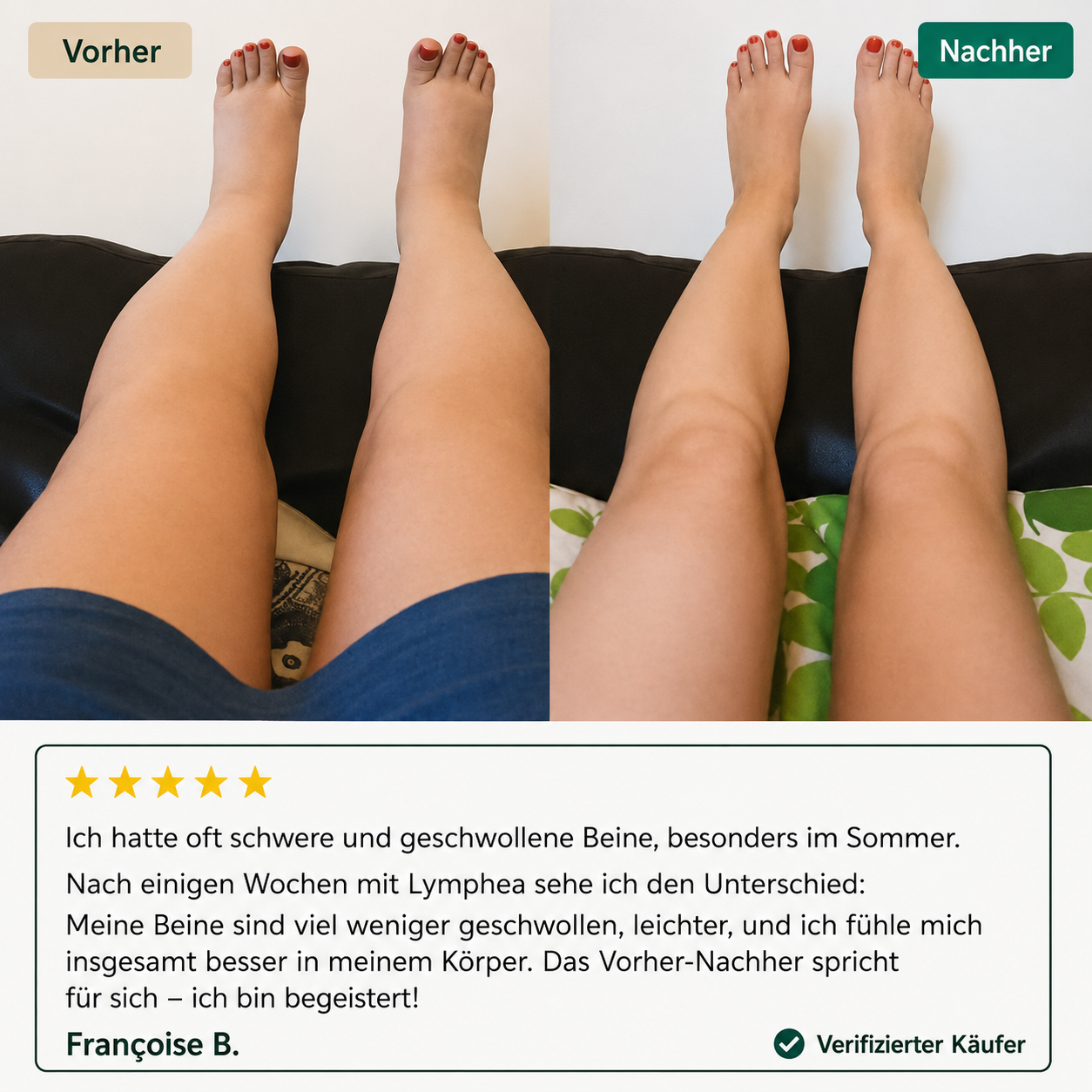 Luveas - Lymphdrainage-Komplex
